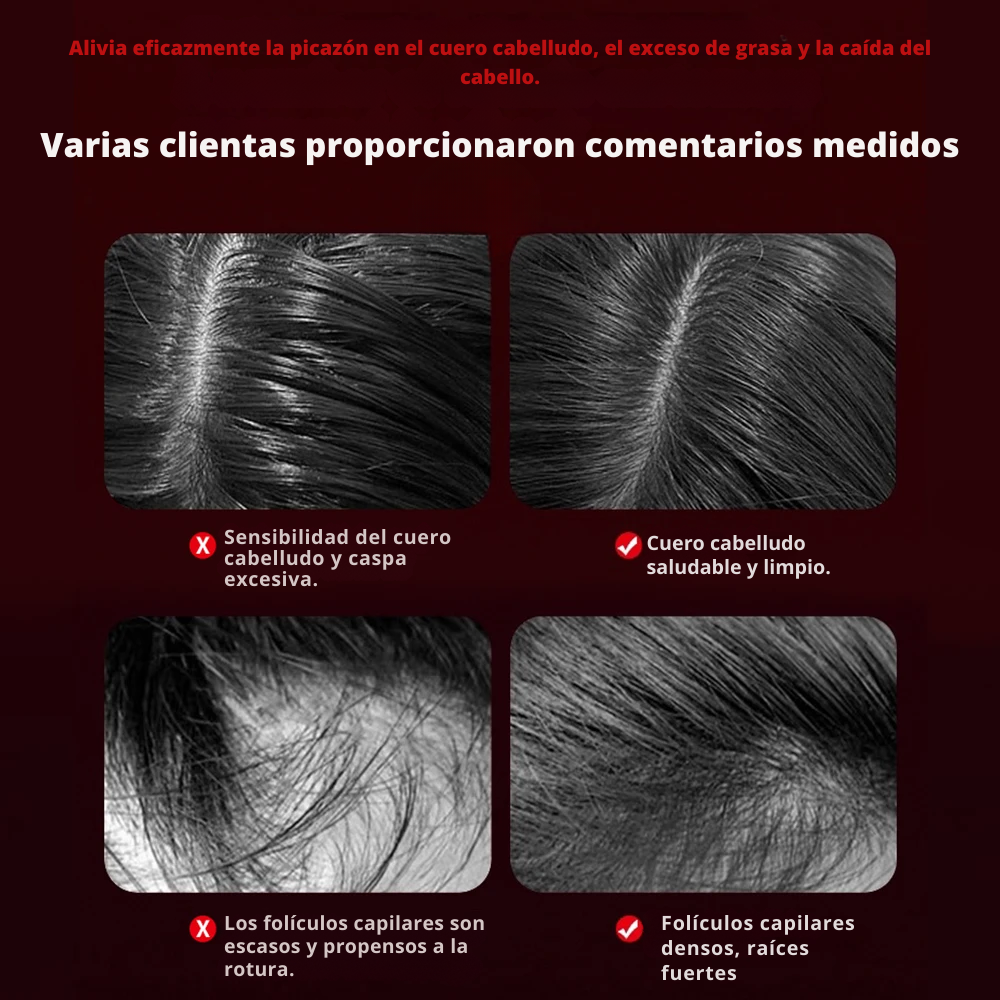 Peine Masajeador de Cabello con Luz Roja Eléctrica | Fortalecedor & Reductor de Caída